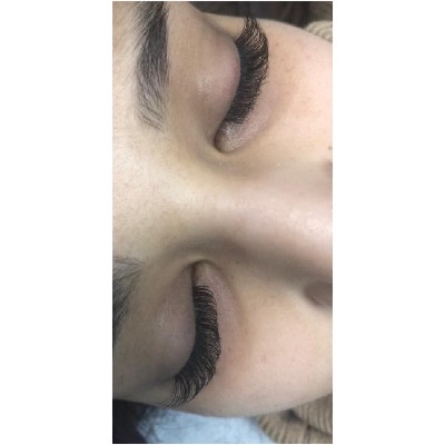 eyes treatments in Redhill