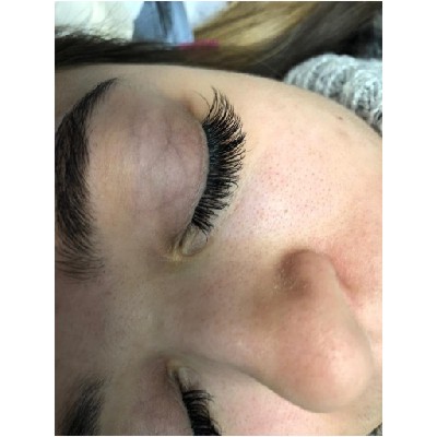 eyes treatments in Redhill